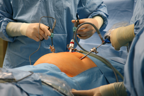 Minimalinvasive Chirurgie