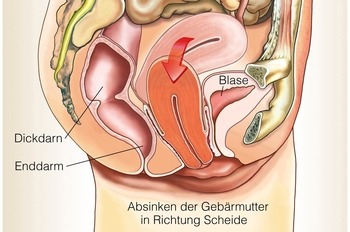 Beckenbodenzentrum